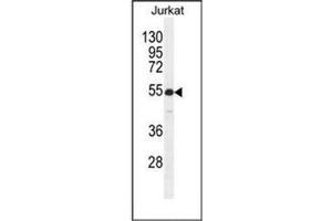 Western blot analysis of  RBPJL Antibody (N-term) in Jurkat cell line lysates (35ug/lane). (RBPJL antibody  (N-Term))