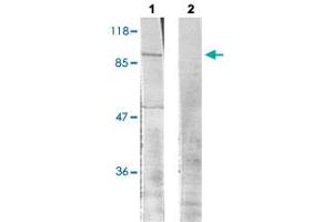 Western blot analysis of Lane 1: UV treated 293 cells, Lane 2: antigen-specific peptide treated 293 cells with RPS6KA1 (phospho T573) polyclonal antibody  at 1:500-1:1000 dilution. (RPS6KA1 antibody  (pThr573))
