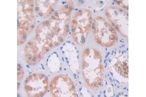 Used in DAB staining on fromalin fixed paraffin- embedded Kidney tissue (Ancient Ubiquitous Protein 1 antibody  (AA 201-410))