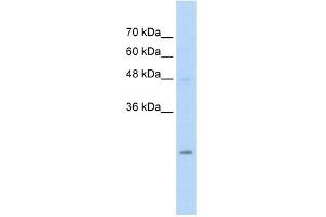 WB Suggested Anti-HIP2 Antibody Titration:  5. (UBE2K antibody  (N-Term))