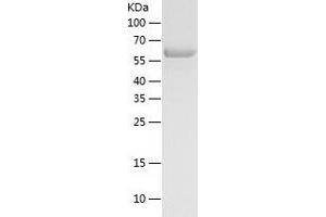 Western Blotting (WB) image for Karyopherin alpha 2 (RAG Cohort 1, Importin alpha 1) (KPNA2) (AA 1-529) protein (His tag) (ABIN7123665) (KPNA2 Protein (AA 1-529) (His tag))