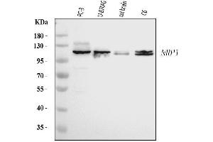 Western blot analysis of Neuropilin 1 using anti-Neuropilin 1 antibody (ABIN7601920).
