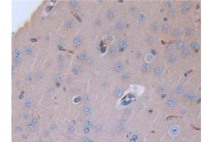 Detection of LCNL1 in Rat Cerebrum Tissue using Polyclonal Antibody to Lipocalin Like Protein 1 (LCNL1) (LCNL1 antibody)