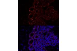 Immunofluorescence analysis of Mouse brown adipose using Perilipin-2 antibody (ABIN7269220) at dilution of 1:100 (40x lens). (ADRP antibody)