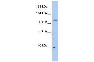 NEDD4L antibody used at 1 ug/ml to detect target protein.