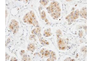 IHC-P Image Immunohistochemical analysis of paraffin-embedded Pheochromocytoma xenograft, using DLC1, antibody at 1:100 dilution. (DLC1 antibody  (N-Term))