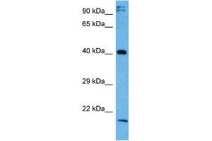 Host:  Rabbit  Target Name:  NFKBIB  Sample Tissue:  Mouse Testis  Antibody Dilution:  1ug/ml (NFKBIB antibody  (Middle Region))
