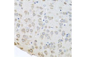 Immunohistochemistry of paraffin-embedded mouse brain using PABPC4 antibody (ABIN5973544) at dilution of 1/100 (40x lens). (PABPC4 antibody)