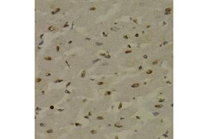 Immunohistochemistry of paraffin-embedded rat heart using NFKB2 antibody at dilution of 1:200 (400x lens). (NFKB2 antibody)