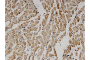 Immunoperoxidase of monoclonal antibody to DECR1 on formalin-fixed paraffin-embedded human heart. (DECR1 antibody  (AA 236-335))