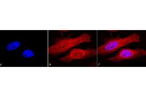 Immunocytochemistry/Immunofluorescence analysis using Rabbit Anti-Alpha B Crystallin Polyclonal Antibody (ABIN361836 and ABIN361837).
