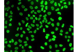 Immunofluorescence analysis of U2OS cells using TMPO antibody. (Thymopoietin antibody)