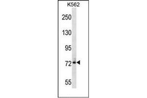 Western blot analysis of DNAI1 Antibody (N-term) in K562 cell line lysates (35ug/lane). (DNAI1 antibody  (N-Term))
