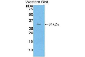 Western Blotting (WB) image for anti-Inhibitory Subunit of NF-KappaB zeta (AA 414-654) antibody (ABIN1859324) (Inhibitory Subunit of NF-KappaB zeta (AA 414-654) antibody)
