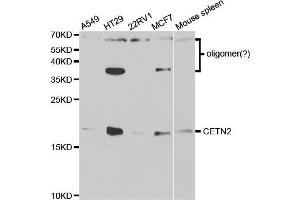 Western Blotting (WB) image for anti-Centrin, EF-Hand Protein, 2 (CETN2) antibody (ABIN1876585) (CETN2 antibody)