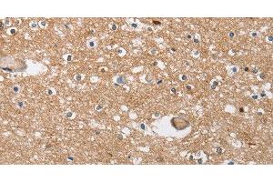 Immunohistochemistry of paraffin-embedded Human brain tissue using SOCS2 Polyclonal Antibody at dilution 1:40 (SOCS2 antibody)
