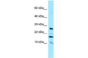 WB Suggested Anti-CBLN3 Antibody Titration: 1. (CBLN3 antibody  (N-Term))