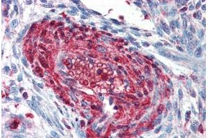 Human Uterus, Vessel (formalin-fixed, paraffin-embedded) stained with S100A4 antibody ABIN337109 at 2. (s100a4 antibody  (AA 86-98))