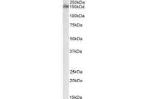 Image no. 1 for anti-CUB and Sushi Multiple Domains 1 (CSMD1) (Internal Region) antibody (ABIN487986) (CSMD1 antibody  (Internal Region))