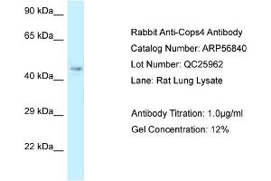 Western Blotting (WB) image for anti-COP9 Signalosome Subunit 4 (COPS4) (N-Term) antibody (ABIN970429) (COPS4 antibody  (N-Term))