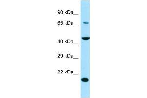 WB Suggested Anti-SLC13A4 Antibody Titration: 1. (SLC13A4 antibody  (Middle Region))