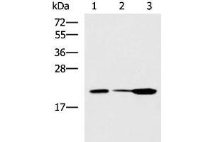 Western blot analysis of Mouse small intestines tissue Mouse kidney tissue Mouse pancreas tissue lysates using PPIC Polyclonal Antibody at dilution of 1:550 (PPIC antibody)