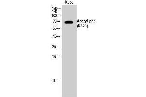 Tumor Protein p73 anticorps  (acLys321)