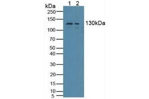 Figure. (NCOA3 antibody  (AA 1023-1304))
