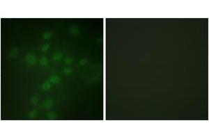 Immunofluorescence analysis of HuvEc cells, using Telomerase (Phospho-Ser227) Antibody. (TERT antibody  (pSer227))