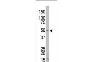 Antibody is used in Western blot to detect STK35 in mouse kidney tissue lysate. (STK35 antibody  (AA 374-404))