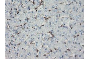 Immunohistochemical staining of paraffin-embedded Human liver tissue using anti-GIMAP4 mouse monoclonal antibody. (GIMAP4 antibody)