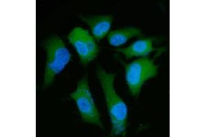 IF analysis of PPP2R1A using anti-PPP2R1A antibody (ABIN7603081).