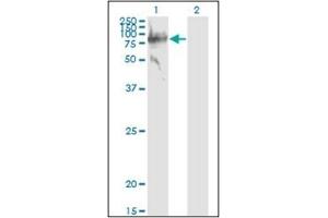 Western Blotting (WB) image for anti-Serpin Peptidase Inhibitor, Clade G (C1 Inhibitor), Member 1 (SERPING1) (AA 1-501) antibody (ABIN782340) (SERPING1 antibody  (AA 1-501))