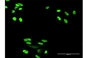Immunofluorescence (IF) image for anti-X-Ray Repair Complementing Defective Repair in Chinese Hamster Cells 6 (XRCC6) (AA 1-609) antibody (ABIN947890)