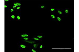 Immunofluorescence of purified MaxPab antibody to XRCC6 on HeLa cell.
