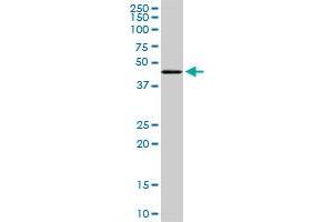 Western Blotting (WB) image for anti-Transcriptional Adaptor 2B (TADA2B) (AA 2-111) antibody (ABIN466261) (TADA2B antibody  (AA 2-111))