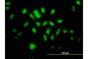 Immunofluorescence of monoclonal antibody to MTA1 on HeLa cell. (MTA1 antibody  (AA 601-700))