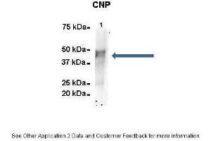 Immunoprecipitation (IP) image for anti-2',3'-Cyclic Nucleotide 3' phosphodiesterase (CNP) (N-Term) antibody (ABIN2778175)