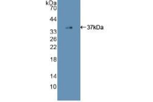 Western blot analysis of recombinant Human EGFR2. (EGFR antibody  (AA 713-984))