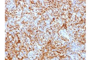 Formalin-fixed, paraffin-embedded human Spleen stained with CD61 Rabbit Recombinant Monoclonal Antibody (ITGB3/2166R). (Recombinant Integrin beta 3 antibody  (AA 385-490))