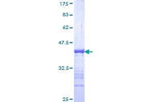 GATAD2B Protein (AA 3-110) (GST tag)