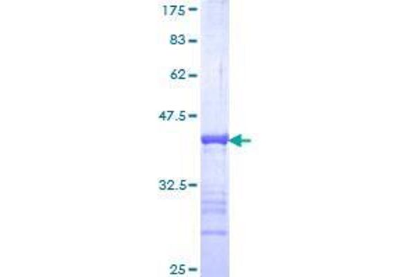 GATAD2B Protein (AA 3-110) (GST tag)