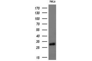 Western Blotting (WB) image for anti-Adiponectin (ADIPOQ) (AA 19-244) antibody (ABIN2715778) (ADIPOQ antibody  (AA 19-244))