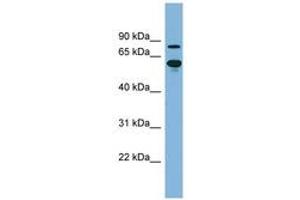 Image no. 1 for anti-ATP-Binding Cassette, Sub-Family F (GCN20), Member 2 (ABCF2) (AA 143-192) antibody (ABIN6741721) (ABCF2 antibody  (AA 143-192))