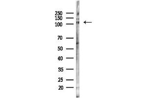 anti-Mitogen-Activated Protein Kinase Kinase Kinase 13 (MAP3K13) (N-Term) antibody