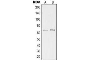 Western blot analysis of TESK1 expression in K562 (A), rat kidney (B) whole cell lysates.
