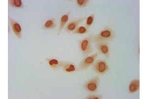 Immunocytochemistry analysis of ABIN7139600 diluted at 1:5 and staining in Hela cells performed on a Leica BondTM system. (H2AFZ antibody  (meLys4))