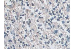 Immunohistochemistry (IHC) image for anti-Mitogen-Activated Protein Kinase 3 (MAPK3) (AA 75-312) antibody (ABIN7433528)