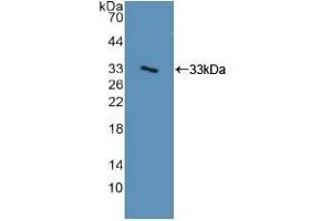 Detection of Recombinant ITGa2, Human using Polyclonal Antibody to Integrin Alpha 2 (ITGa2) (ITGA2 antibody  (AA 74-277))