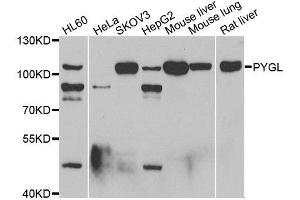 Western blot analysis of extracts of various cell lines, using PYGL antibody. (PYGL antibody)